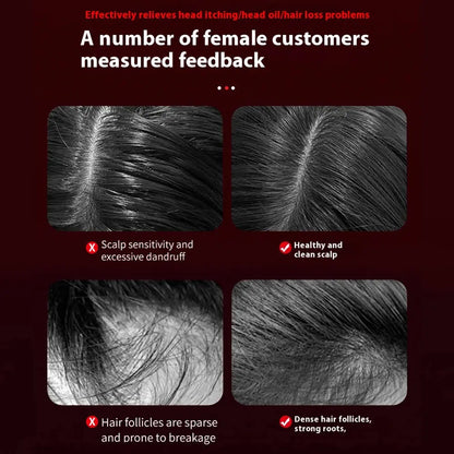 Electric Vibration Massage Comb Red Light Hair Follicle Comb Scalp Oil Liquid Applicator Head Massager Hair Growth Anti Loss Vibes