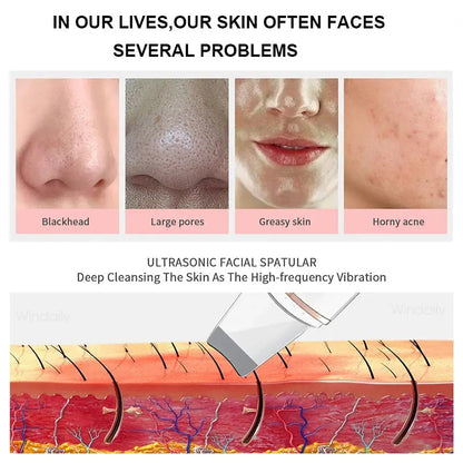 Ultrasonic Skin Scrubber Vibration Face Spatula Blackhead Remover Shovel Clean Cavitation Peeling Facial Lifting Skin Care Tools Vibes