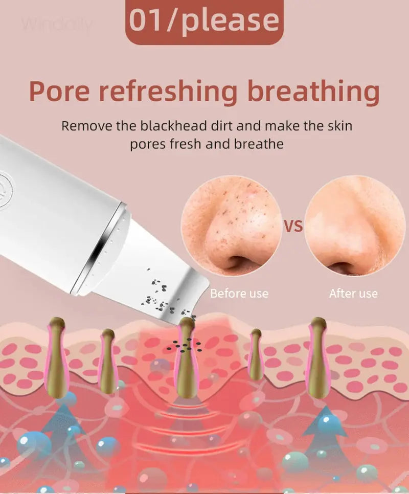 Ultrasonic Skin Scrubber Vibration Face Spatula Blackhead Remover Shovel Clean Cavitation Peeling Facial Lifting Skin Care Tools Vibes